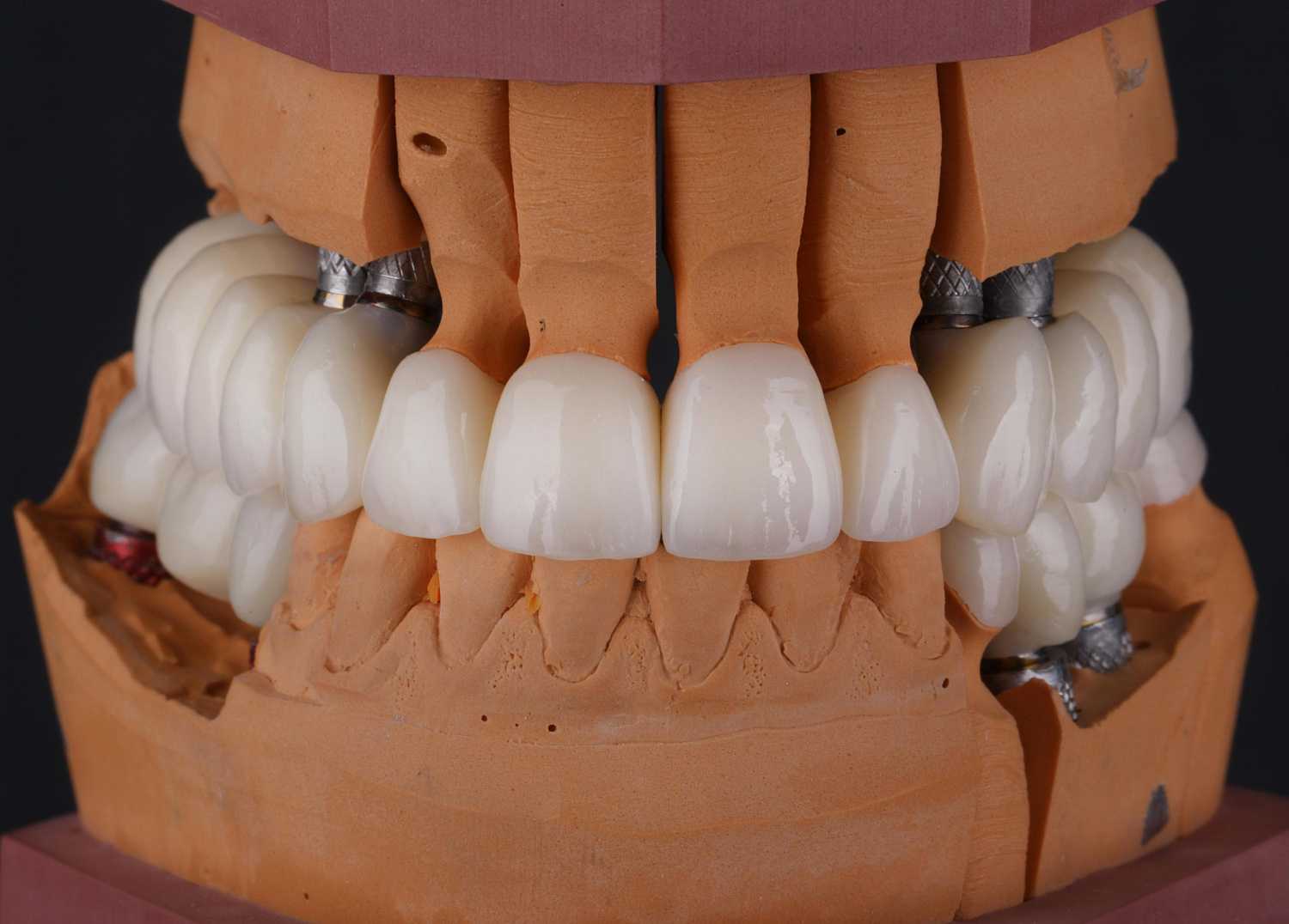 Cовременные технологии в создании искусственных зубов